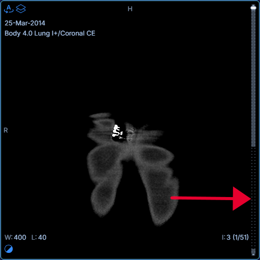 viewportScrollbar.showLoadingPattern: Dotted loading pattern